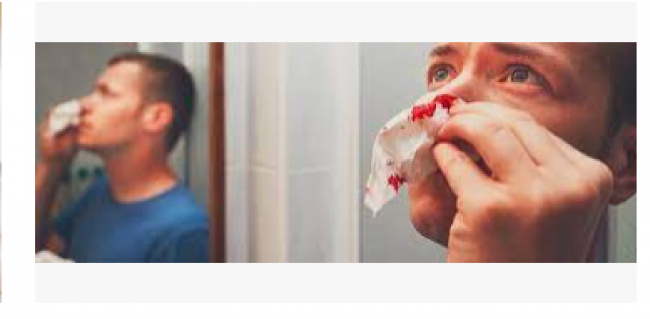 Nueva terapia para pacientes hemofílicos busca disminuir sangrados