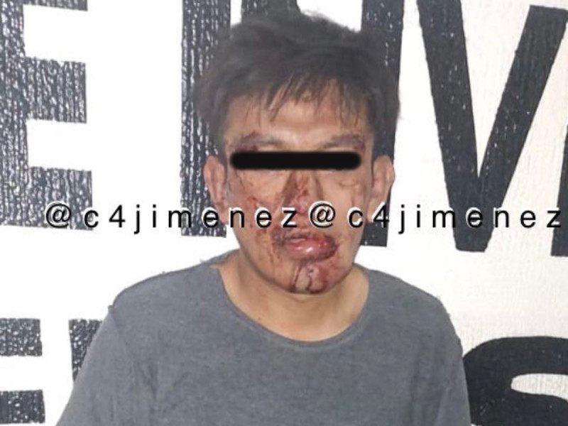 Paciente intentó abusar de una empleada de limpieza en Hospital Balbuena de CDMX